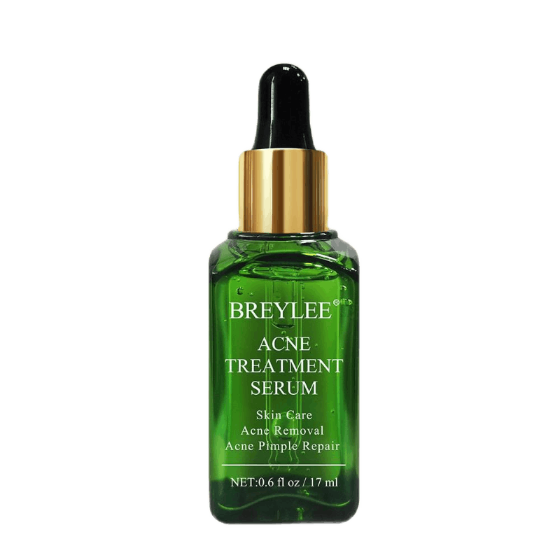 10 vị trí mọc mụn: vị trí nào cho thấy sức khỏe có vấn đề? 4