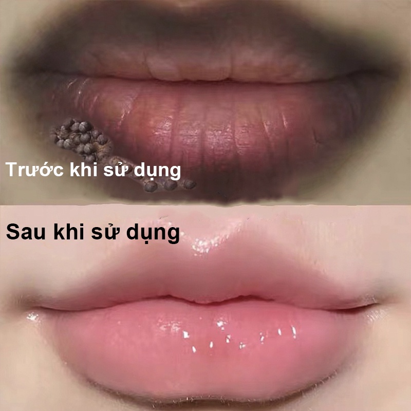 【Thâm môi】mặt nạ môi, kem môi, chăm sóc vùng môi, tinh chất chăm sóc trẻ hóa môi, dưỡng ẩm môi, phục hồi môi khô nứt