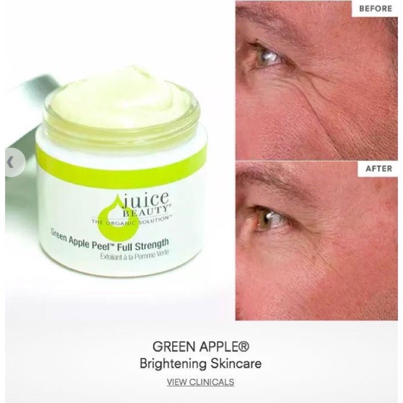 Mặt nạ tẩy da chết Juice Beauty GREEN APPLE PEEL FULL STRENGTH EXFOLIATING MASK