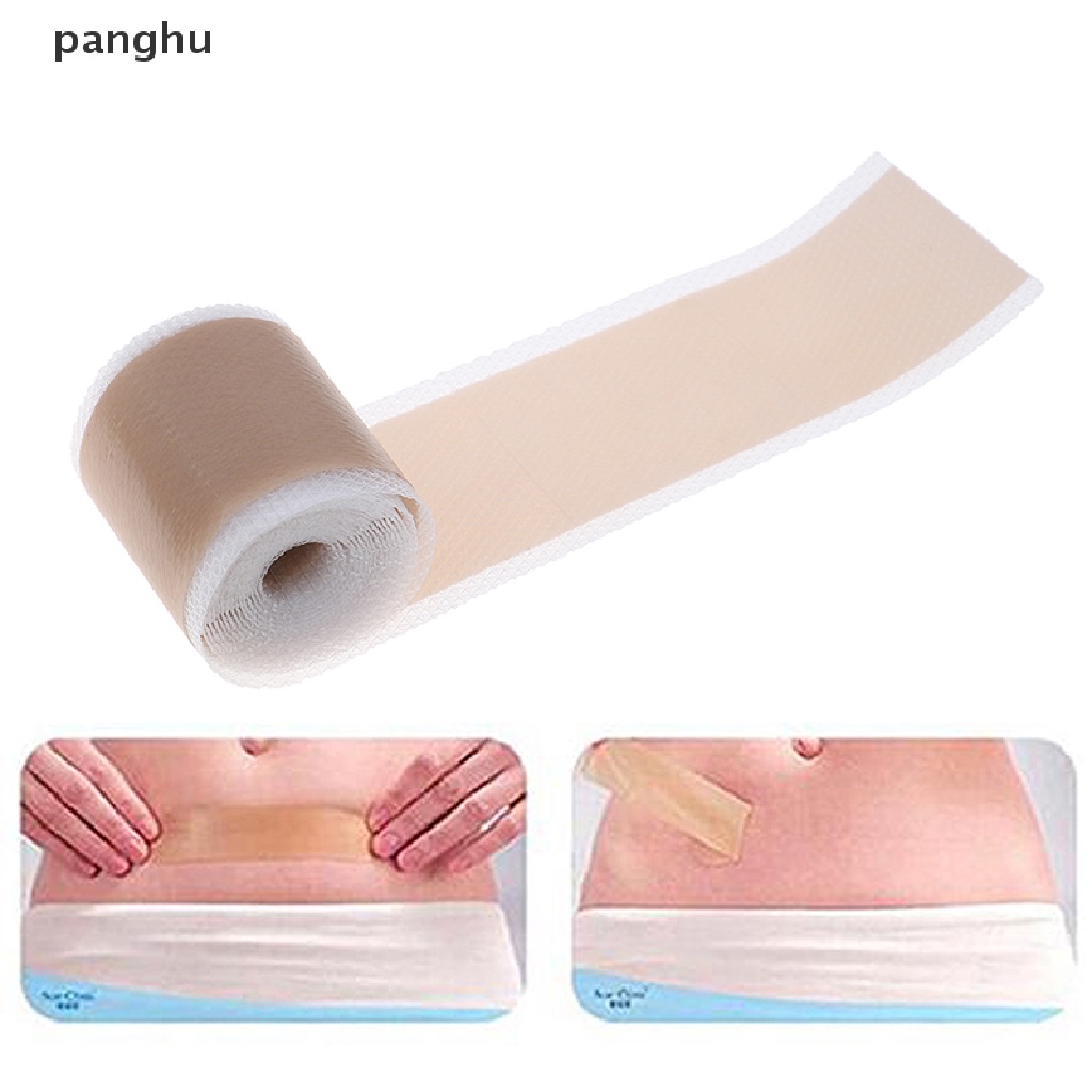 [Hàng mới về] Cuộn miếng dán gel silicone xóa giảm vết sẹo 4x150cm
