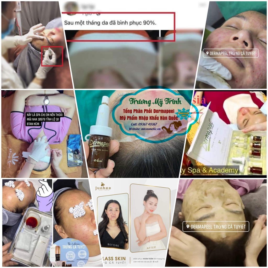 Combo sạch mụn mờ thâm mụn dermapeel - tảo trứng cá tuyết - serum trứng cá tuyết - nạ derma dịu da nhanh
