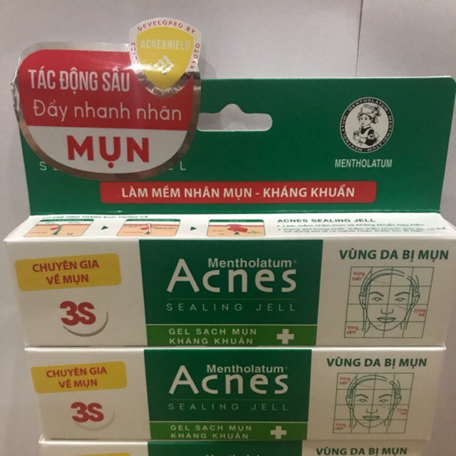 kem làm sạch mụn và kháng khuẩn Acnes mentholatum