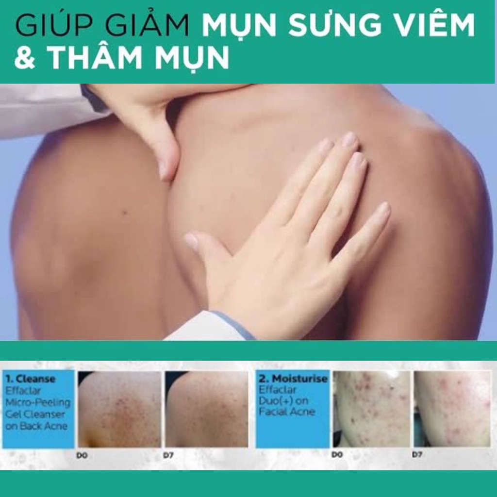 Gel Rửa Mặt Và Tắm Giảm Mụn La Roche-Posay Effaclar Micro-Peeling Purifying Gel 50ml - Xanh Lá