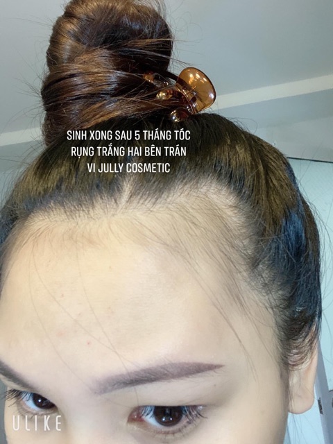 Xịt dưỡng tóc VIJULLY hair lotion | BigBuy360 - bigbuy360.vn