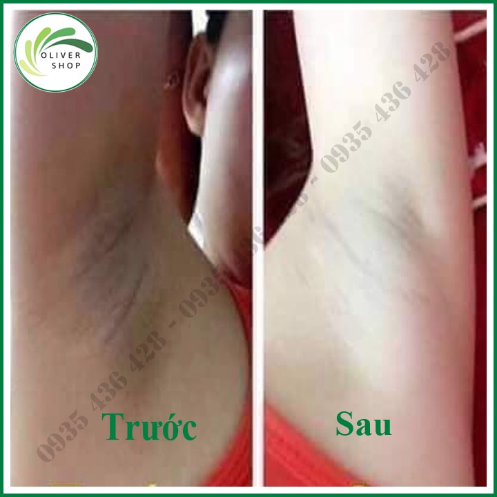Khử Hôi Nách Thâm Nách ⚡SIÊU TO+QUÀ TẶNG⚡ Kem Cô Bơ Size Lớn Siêu Tiết Kiệm Chính Hãng 100%