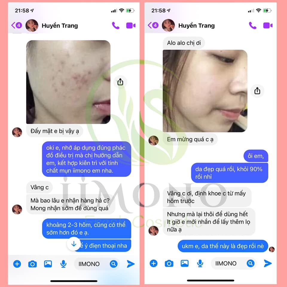 Serum giảm mụn, ngừa thâm, và chăm sóc da IIMONO | BigBuy360 - bigbuy360.vn