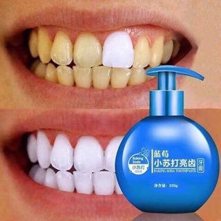 [Sẵn] KEM ĐÁNH RĂNG BACKINGSODA