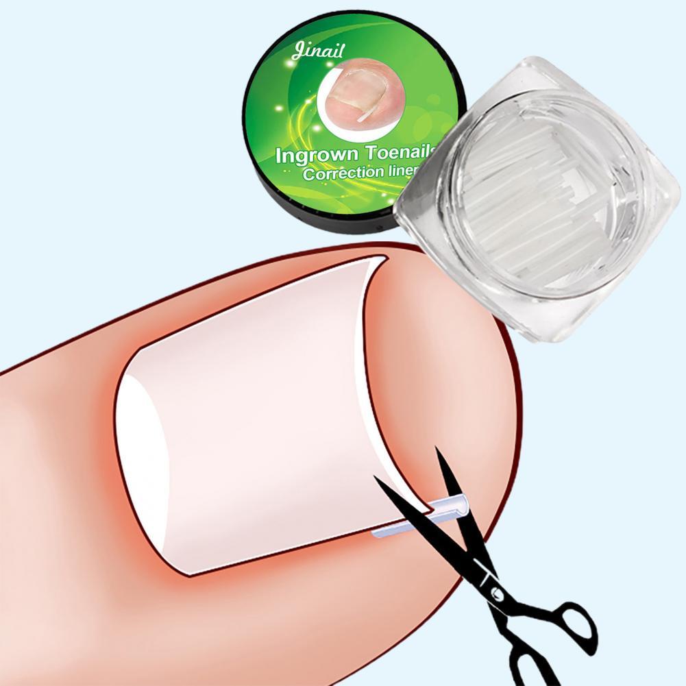 Set 10 Dụng Cụ Chỉnh Sửa Móng Chân / Móng Chân Siêu Mỏng Dùng Một Lần
