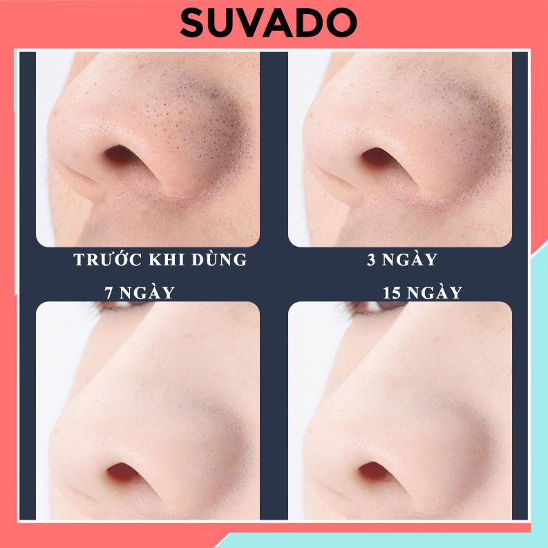 Máy hút mụn cầm tay mini 5 trong 1 đa năng tặng nhiều đầu hút mụn đầu đen, mụn cám, trứng cá 8001 SUVADO