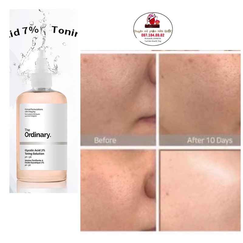 Toner The Ordinary nước hoa hồng giúp sáng da ,giảm mụn