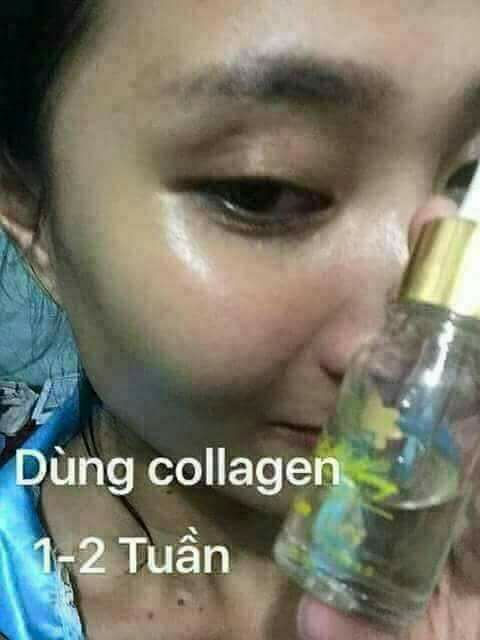 Collagen Tươi