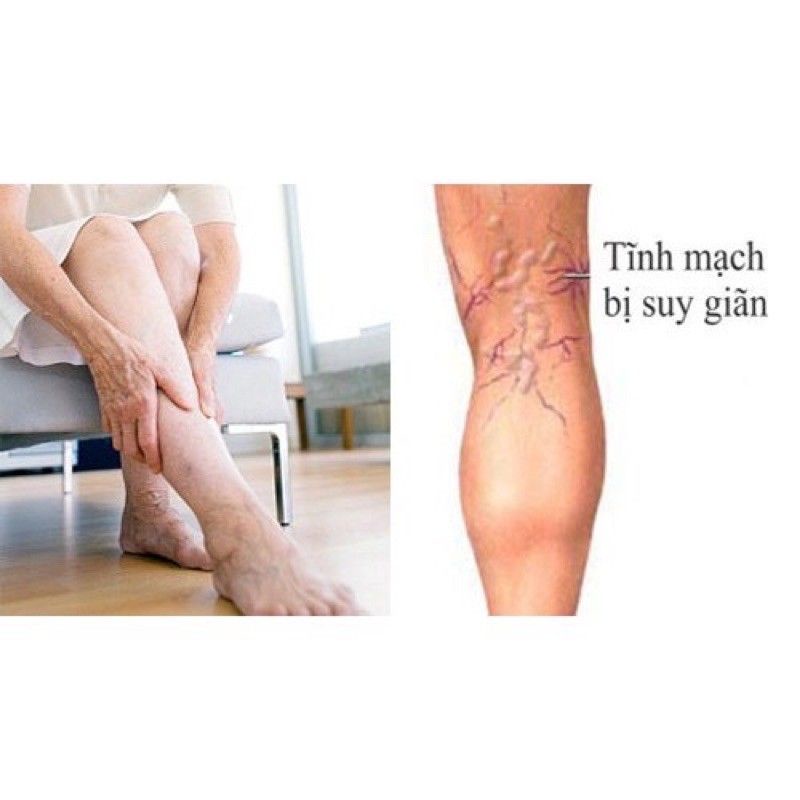 Tĩnh Mạch Khang hộp 30 viên hỗ trợ suy giãn tĩnh mạch tê chân tay