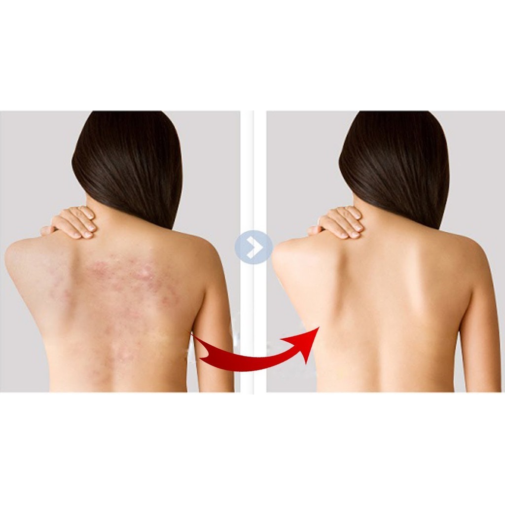 Xà Phòng Dạng Soap For Back Medicated Soap Pelican của Nhật 135gr | BigBuy360 - bigbuy360.vn