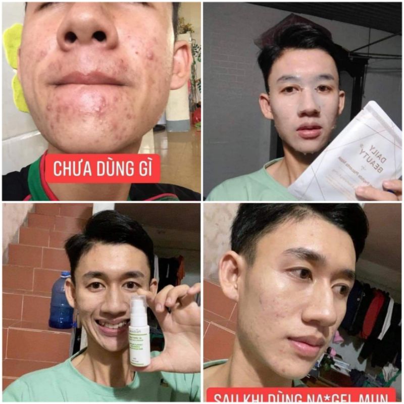 Gel Mụn Ac Spot Care của R&B Hàn Quốc