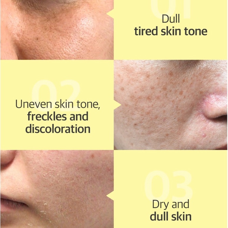 Serum Some By Mi Dưỡng Trắng Da Chiết Xuất Quả Thanh Yên Yuja Niacin 30 Days Blemish Care Serum 50ml - Khongcoson