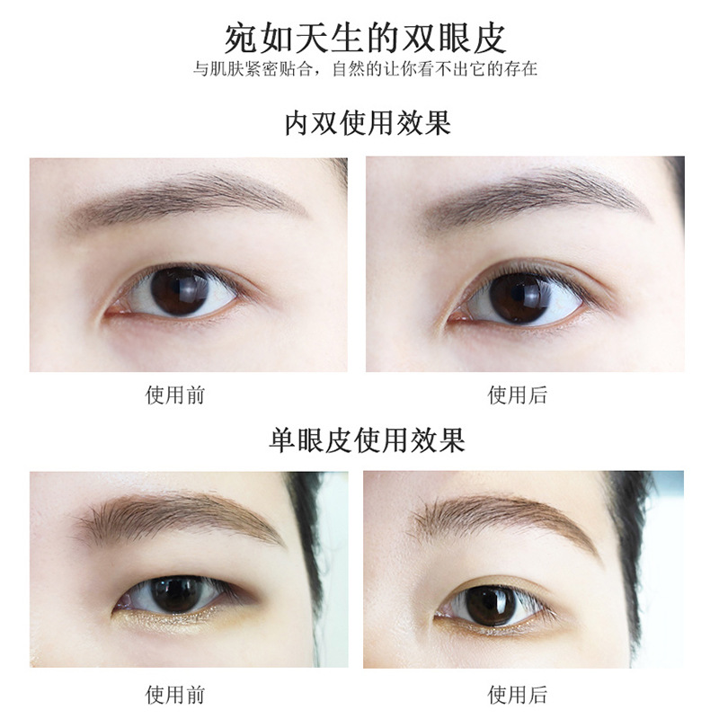 🌱 Mesh Lace Double Eyelid Stickers Roll Eye Stickers Without Trace Natural Flesh Color Invisible Strong Sticky Long-lasting Female | BigBuy360 - bigbuy360.vn