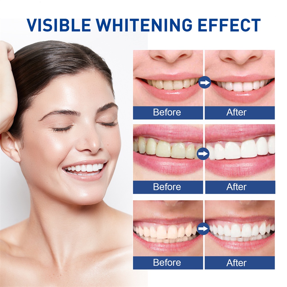 Jaysuing Làm Đẹp Bàn Chải Đánh Răng Làm Sạch Răng Để Loại Bỏ Bụi Bẩn Loại Bỏ Răng Vàng Thuốc Lá Làm Sáng Răng Làm Trắng Răng Vệ Sinh Bút okase
