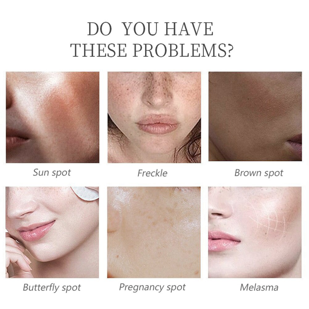 Serum Kojic Acid thể tích 30ml dưỡng ẩm chống lão hóa làm trắng da tự nhiên