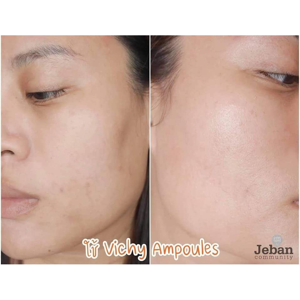 [Mã 66FMCGSALE hoàn 8% xu đơn 500K] Tinh chất cô đặc Viichy Liftactiv Specialist Peptide C Anti Ageing