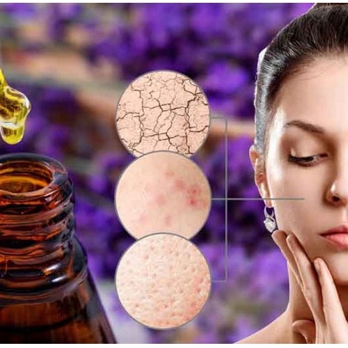 10ml Tinh Dầu Xông Mặt Huân Thảo Giảm Thâm, Thư Giãn