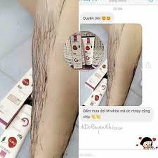 Kem Triệt Lông M'White