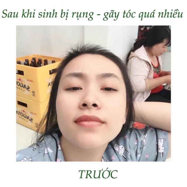 Tinh dầu bưởi Vijully giảm rụng tóc, kích tóc mọc nhanh | BigBuy360 - bigbuy360.vn