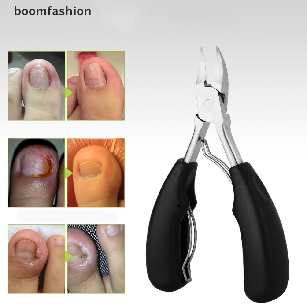 [boomfashion] Toe Nail Clippers Remove Dead Skin Nail Correction Nippers Ingrown Toenail [new]