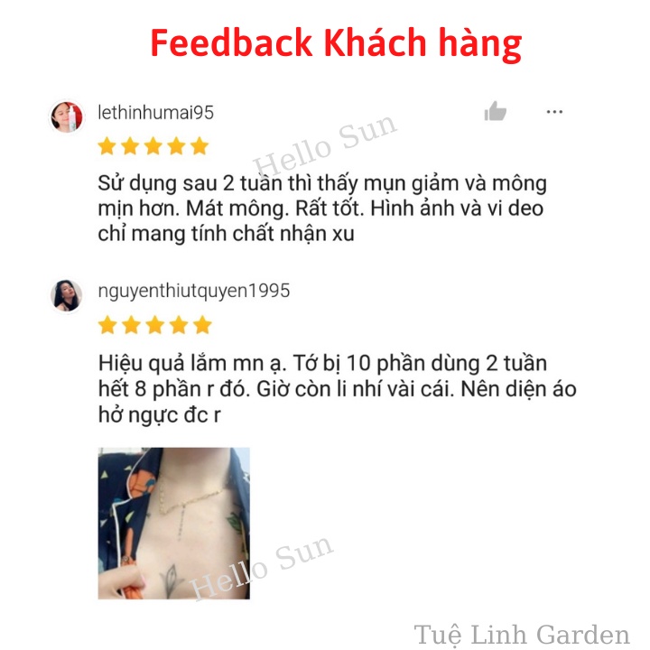 Sữa Tắm Giảm Mụn Thâm Mụn Lưng Freeskin 250ml Ngừa Mụn Lưng Mông Body Mờ Thâm Dưỡng Trắng Da- Shop Hello Sun | BigBuy360 - bigbuy360.vn