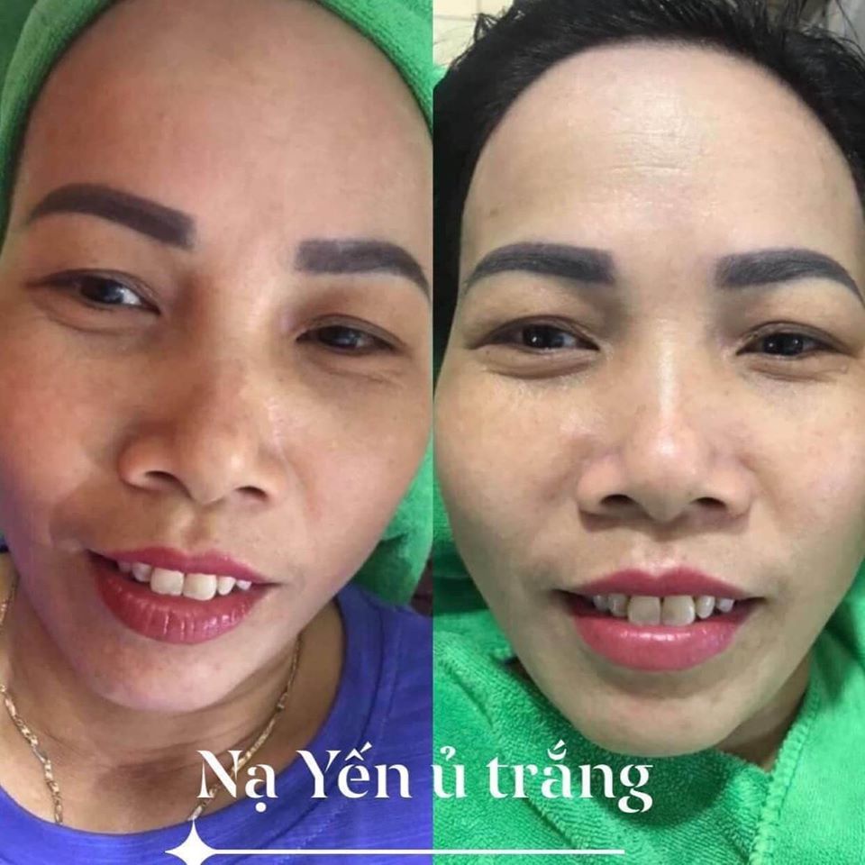 Cấy Trắng Tổ Yến Kim Cương JANG WON - Hàng Chính Hãng