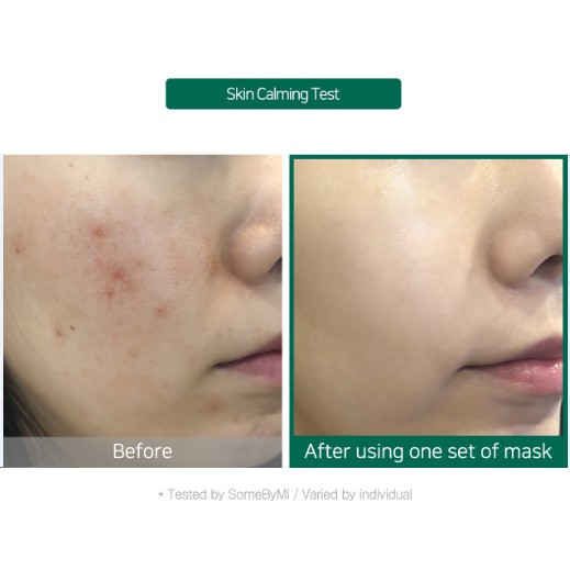 Mặt Nạ Tràm Trà Some By Mi Tea Tree Calming Skeet Mask 25g