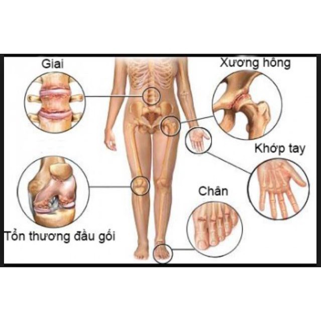 HTN86 - Thuốc Bôi Xương Khớp Nhật Bản Kowa EX W Tinh Dầu Bạc Hà Hộp 90g