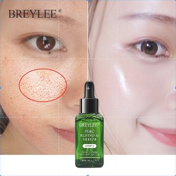 (hàng Mới Về) Set 1 Mặt Nạ Lột Mụn Đầu Đen + Serum Thu Nhỏ Lỗ Chân Lông + 2 Lọ Serum Hiệu Breylee