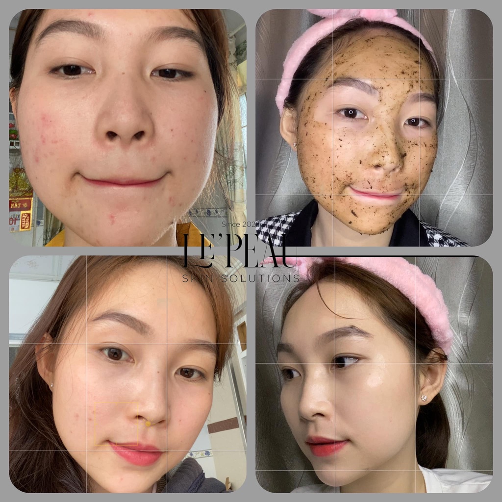 Peel Da Retinol Vi Tảo LE PEAU, Tinh Chất Tái Tạo Da Sinh Học Căng Bóng, Tặng Kèm Serum B5 Phục Hồi - 10ml