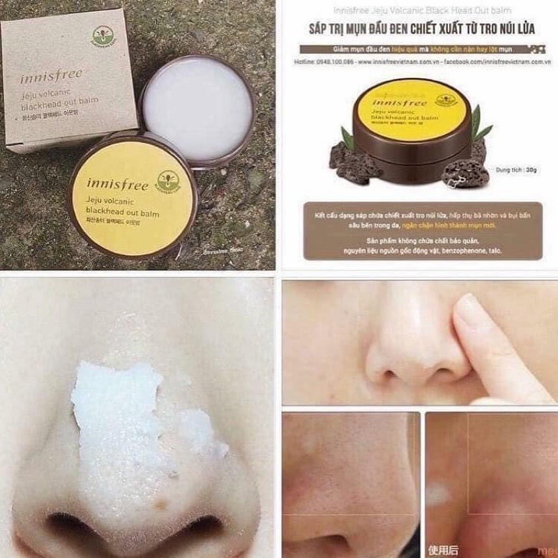 VOLCANIC BLACK HEAD OUT BALM - sáp loại bỏ mụn đầu đen | BigBuy360 - bigbuy360.vn