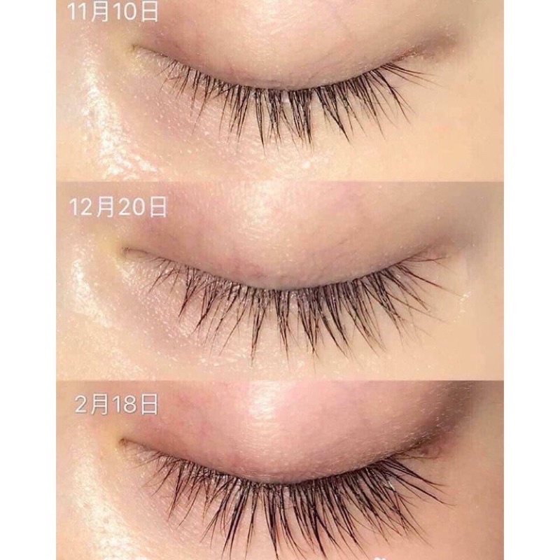 Tinh chất dưỡng mi Eyelash tonic 6.5ml