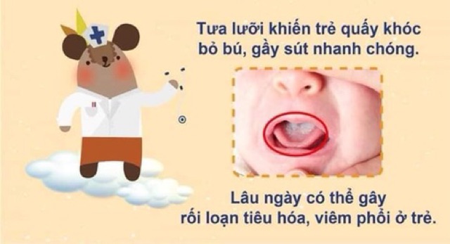 gạc rơ lưỡi baby bro