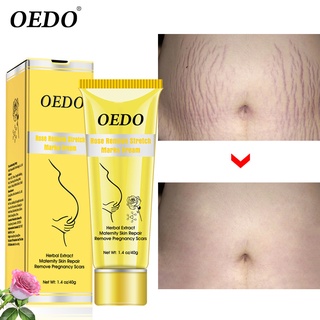 (Hàng Mới Về) Kem Trị Rạn Da Oedo Cao Cấp