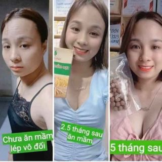 Sỉ 5 hộp kẹo mầm lúa mạch gold
