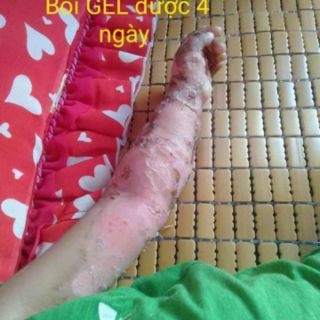 Gel Bôi Da Phú Kang