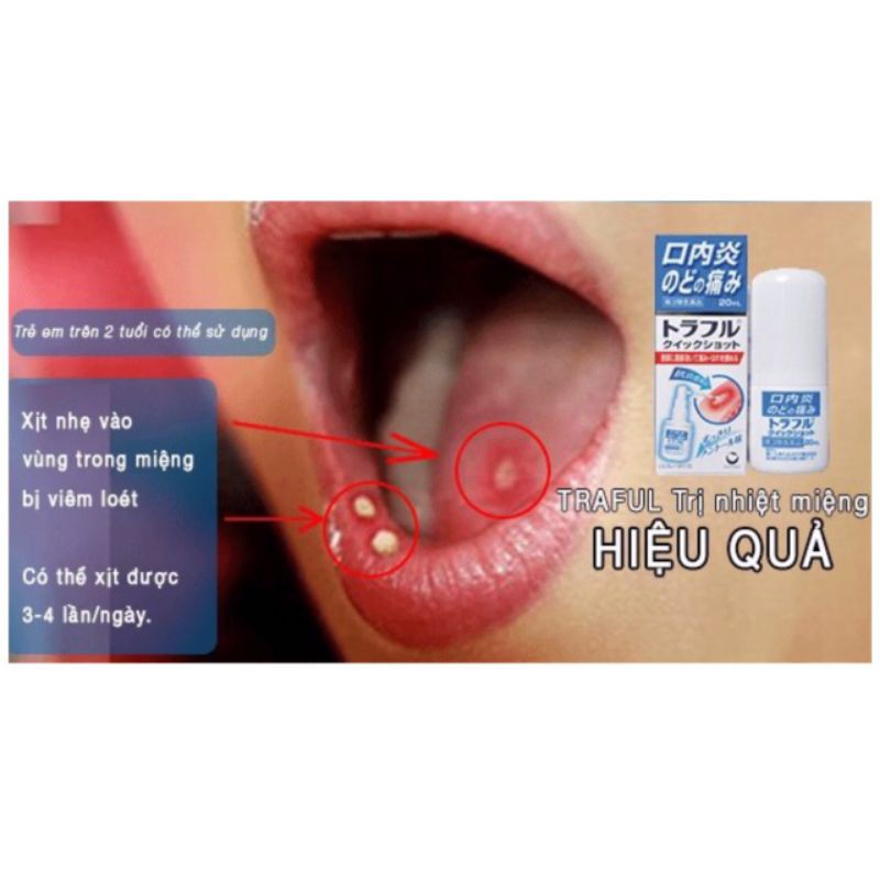 Xịt nhiệt miệng Traful Nhật Bản chai 20ml, Moon Store 9999