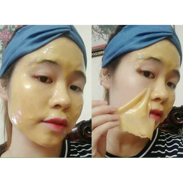 Mặt Nạ Collagen Tươi Vàng 24k Handmade Dưỡng Trắng Da, Mờ Thâm, Nám, Sạm Da - Thẩm Mỹ Huyền Trang NANOCEE
