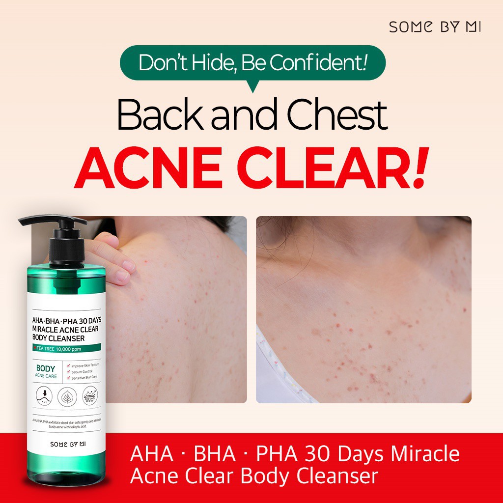 Sữa Tắm Ngừa Mụn Lưng Some By Mi AHA-BHA-PHA 30 Days Miracle Acne Body Cleanser 400g