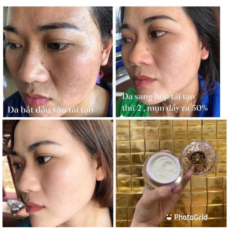 Kem tái tạo chamomileskill