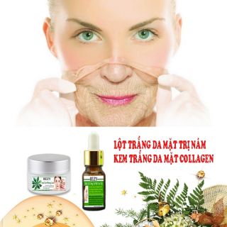 COMBO KEM LỘT TRẮNG DA NÁM