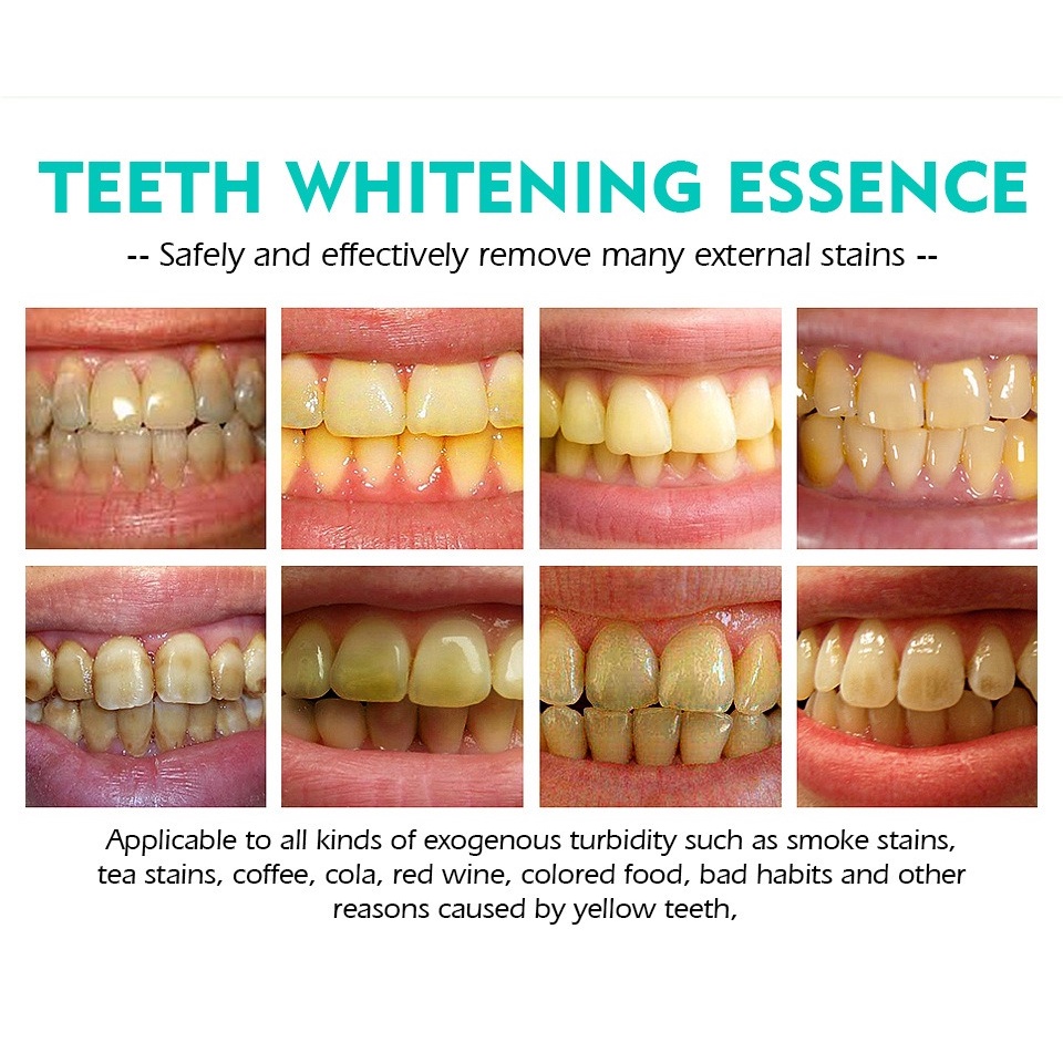 Bút Chăm Sóc Răng Miệng Sáng Tạo Hiệu Quả Dễ Mang Theo Giúp Làm Trắng Răng