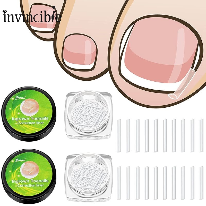 Hộp 1 Hộp Miếng Đệm Co Giãn Chỉnh Sửa Móng Chân Mọc Ngược Trong Suốt Dùng 1 Lần