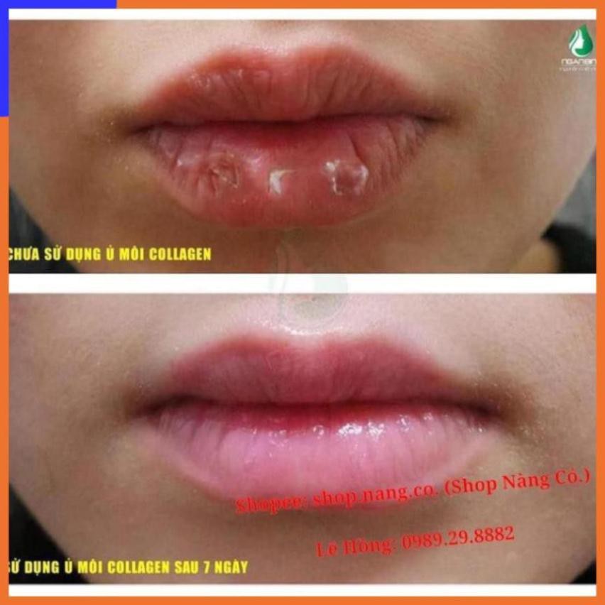 SON Ủ MÔI SHI - MỀN MÔI -DƯỠNG MÔI - HỒNG MÔI - TRỊ THÂM MÔI V V V | BigBuy360 - bigbuy360.vn