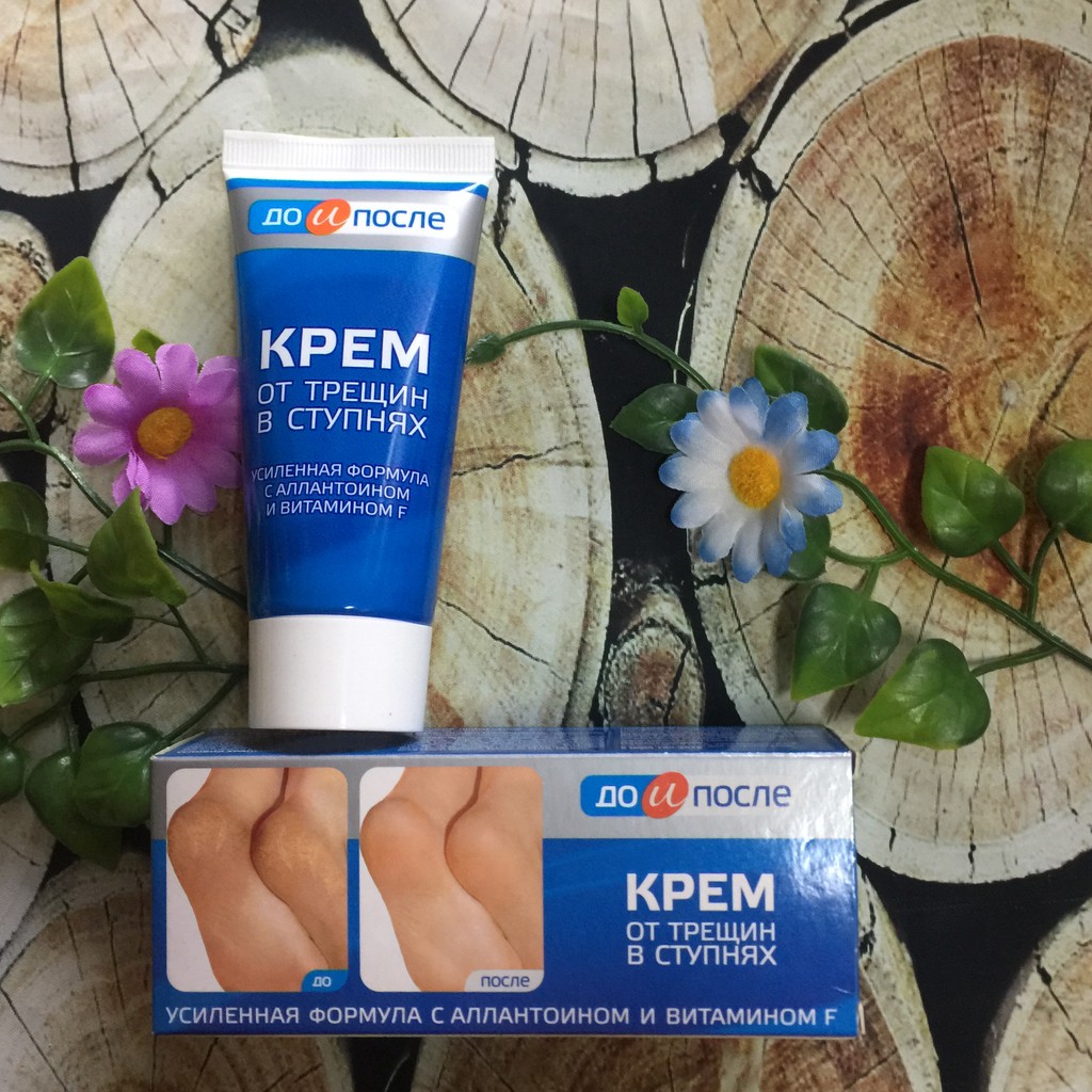 Kem dưỡng ngăn nứt gót chân Kpem 50g