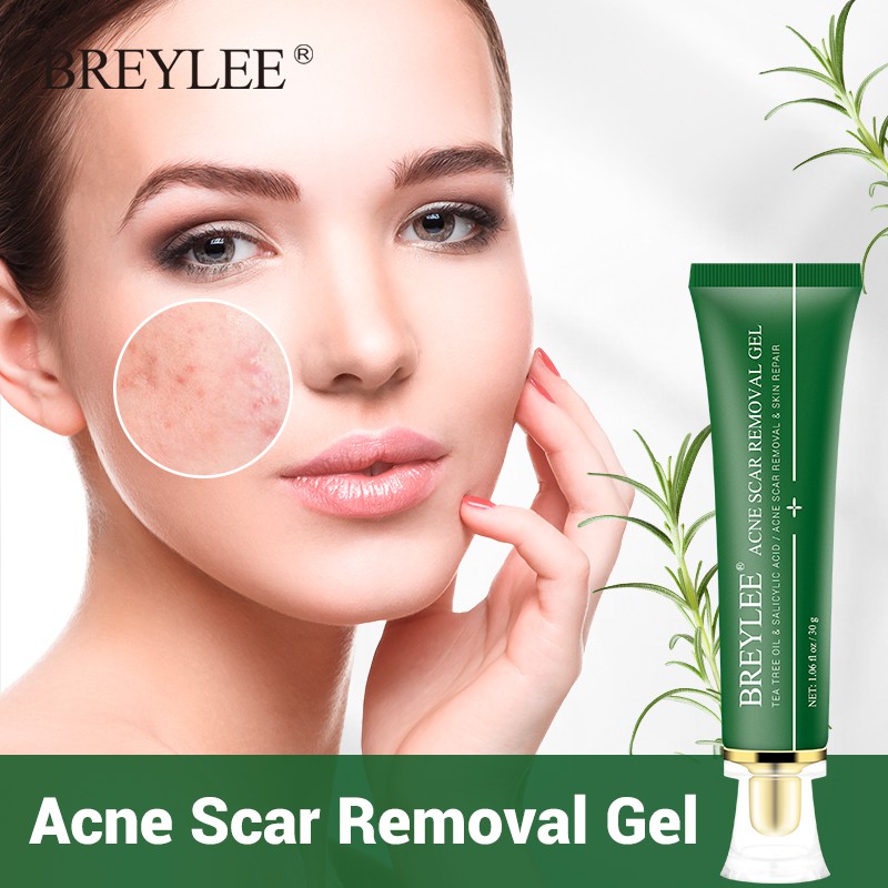 Gel Hỗ Trợ Giảm mụn Breylee 30g làm mờ sẹo dưỡng trắng da | BigBuy360 - bigbuy360.vn