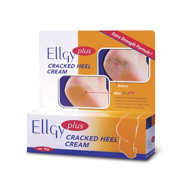 Kem nứt gót Ellgy Plus 25g